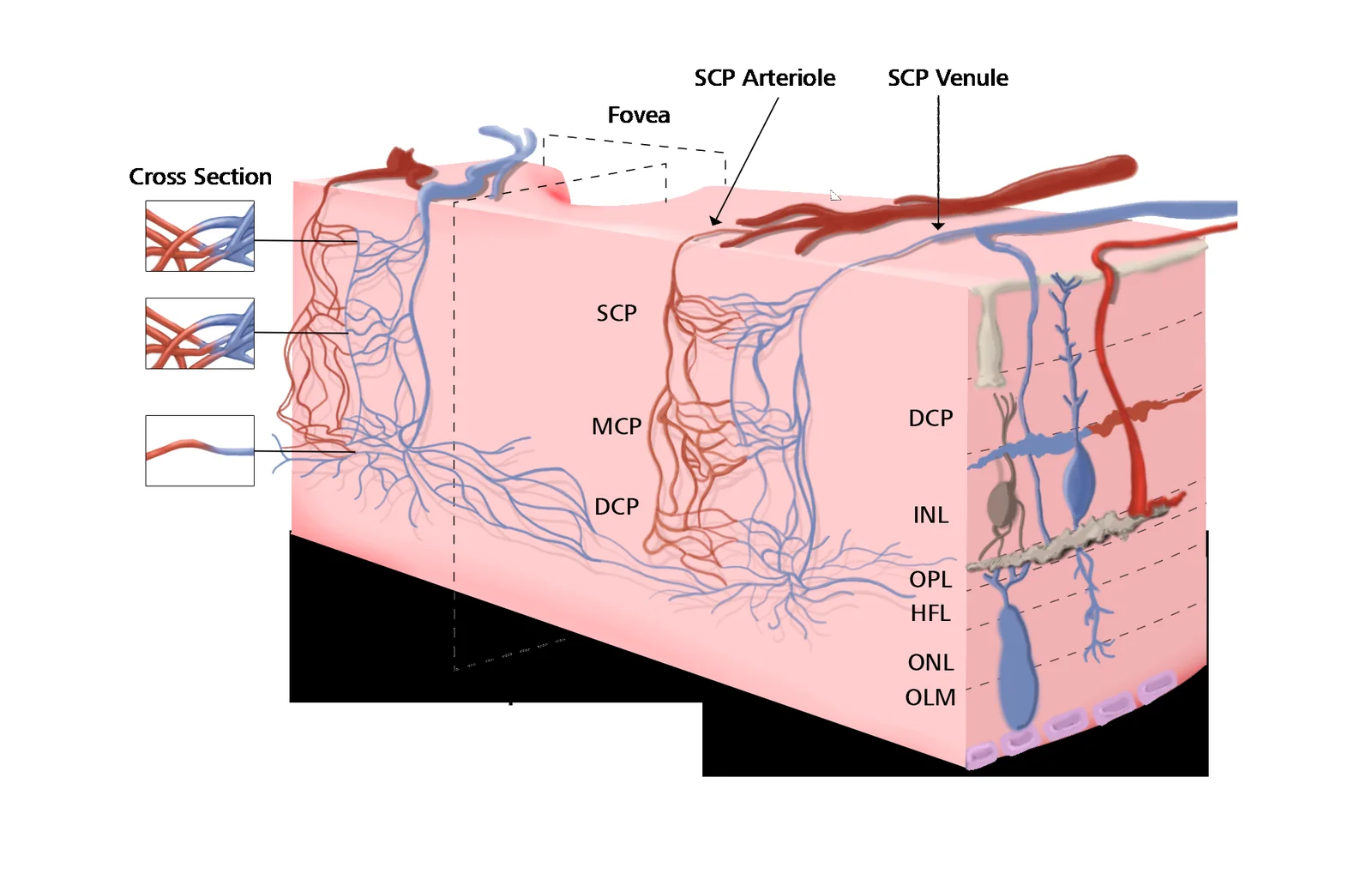 Anatomical illustration of a cutaway block of retina in pink, showing red arterioles and blue venules branching down through the superficial, middle and deep capillary plexus layers, with labelled callouts for the fovea, horizontal raphe, retinal layers and choroid, plus three cross-section detail insets at left.